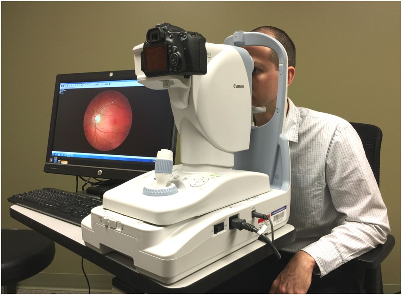OCT Imaging